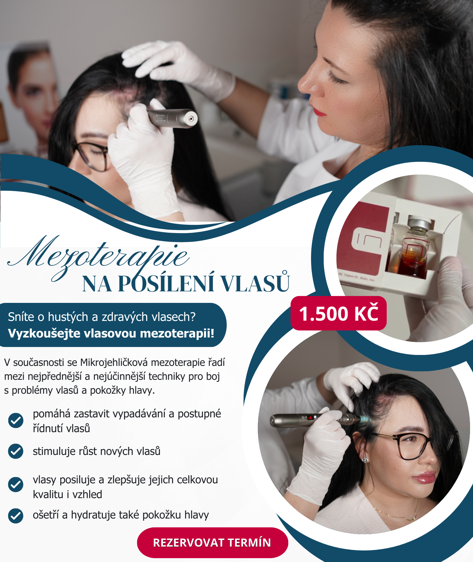 Vlasova mezoterapie | Doelis aesthetic | Praha 1